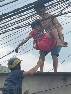 Đồng Nai: 1 Cậu bé thả diều gần dưới đường điện, bị giật bong hết da