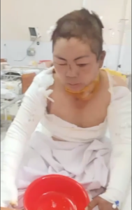 Tình trạng người mẹ bị thằng con nghịch tử đốt xăng
