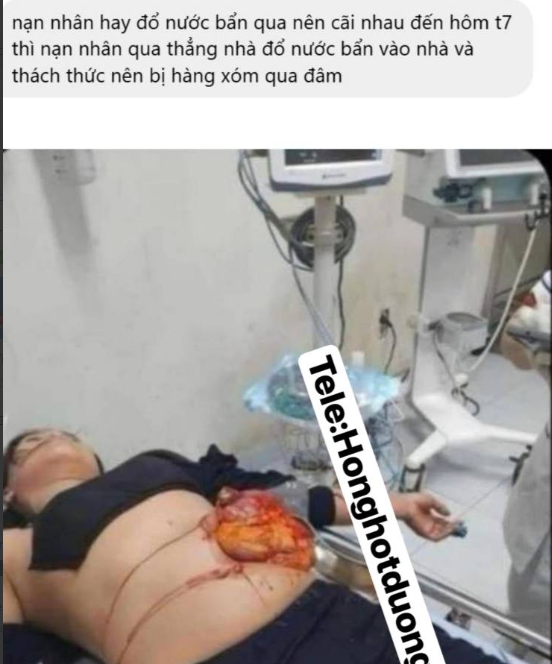 Quảng Nam: Mâu thu/ẫn hàng xóm, ng phụ nữ bị ch/ọc lò/i ru/ột